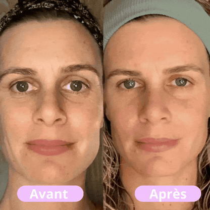 Rolori - Masseur facial LED tonifiant